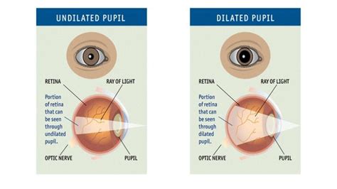 The Dilated Eye Exam Why Its So Important Eye Exam Exam