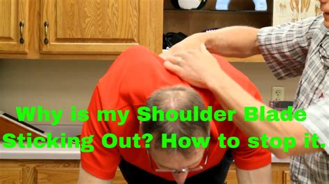 Why Do My Shoulder Blades Stick Out Exercises Stretches Winging Scapula Youtube