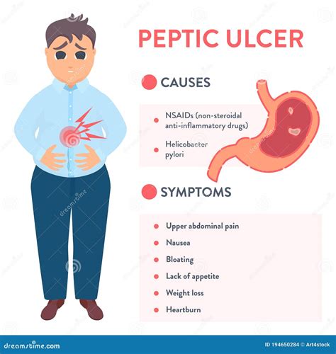 Stomach Peptic Ulcer Signs Symptoms Causes Treatment Vrogue Co