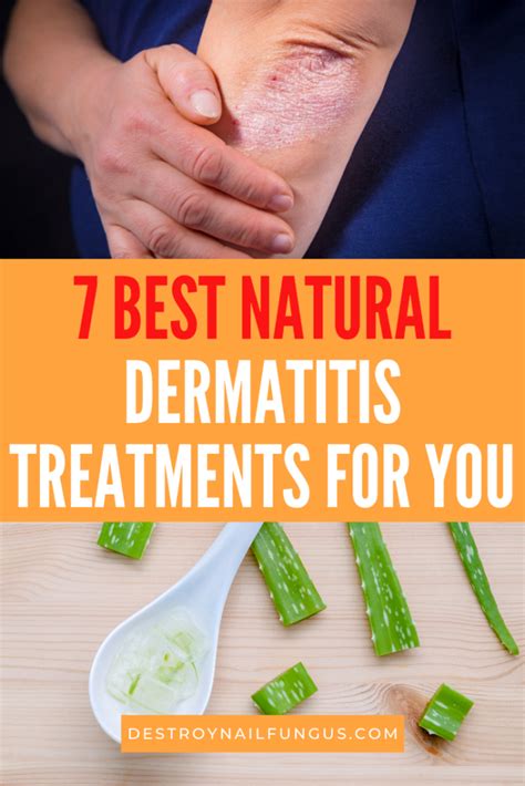 Dermatitis Remedies Natural Treatments For Eczema Relief