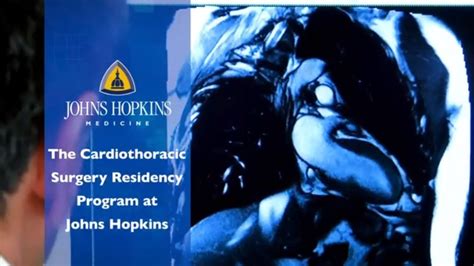 The Cardiothoracic Surgery Residency Program At Johns Hopkins Youtube