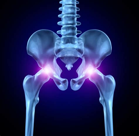 What Causes Myofascial Pelvic Pain Release Works