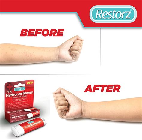 Restorz Hydrocortisone 1 Cream Treatment Stick Fast Acting Relief For