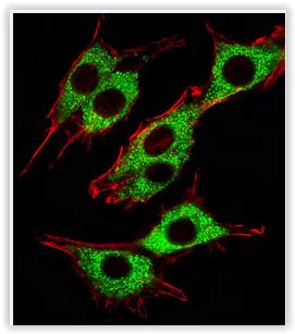 How To Monitor Mitophagy In Mammalian Cells Tebubio S Blog