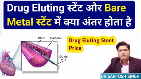 What Are The Differences Between Drug Eluting Stent And Bare Metal