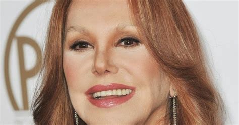 Marlo Thomas Plastic Surgery Nose Job Before And After Facelift Botox
