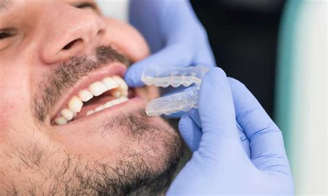 Invisalign Care How To Take Care Of Your Invisalign Aligners