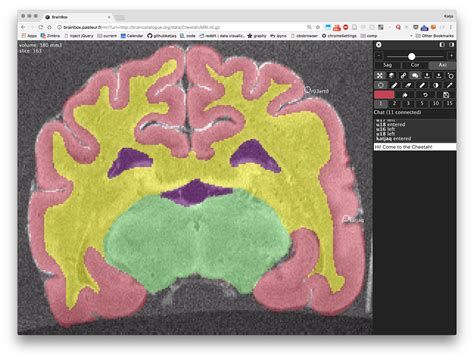 Brainbox Is A Web Application That Lets You Annotate And Segment 3d