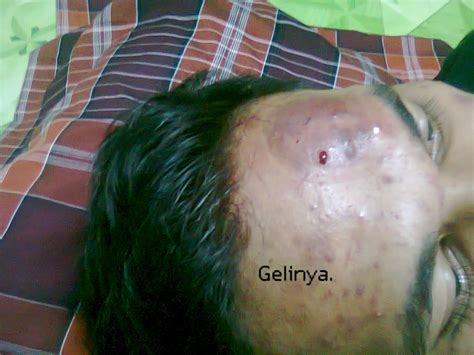 Kita menjadi kurang percaya diri dengan penampilan yang kita miliki. RAWATAN BEKAM SUNNAH PAHANG