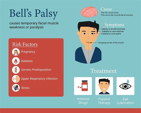 Bell S Palsy Symptoms Causes And Treatment Birla Fertility And Ivf
