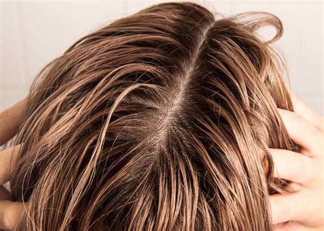 Find out what causes oily hair and how to deal with a greasy hair look quickly and easily with head your body continually produces this oil, potentially leading to oily hair and scalp problems as sticky oil. Dandruff Treatment Shampoo | Oily Dandruff Shampoo