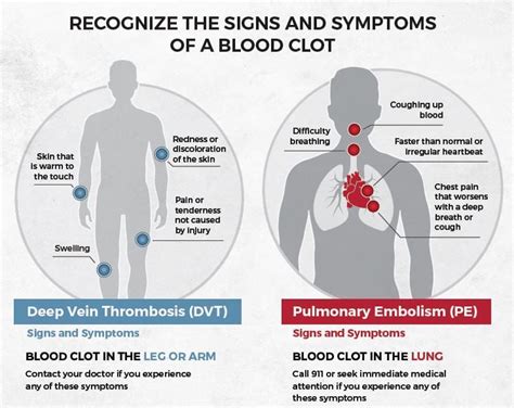 Signs And Symptoms Of Blood Clots