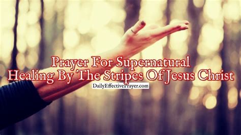 Prayer For Supernatural Healing By The Stripes Of Jesus Christ