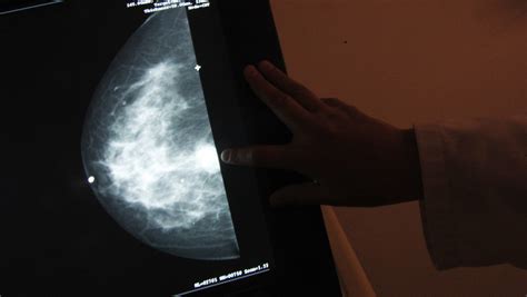 A Polish Government Ad Told Women To Screen Their Breasts For Cancer