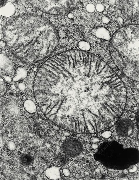 Transmission Electron Micrograph Of Mitochondria Stock Image G465
