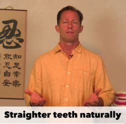 If you have minor orthodontic problems, then clear aligners can be used as a replacement +18889812145. How to Straighten Your Teeth Without Braces | OraWellness