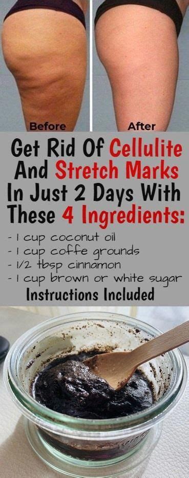 Pin On Best Way To Get Rid Of Cellulite