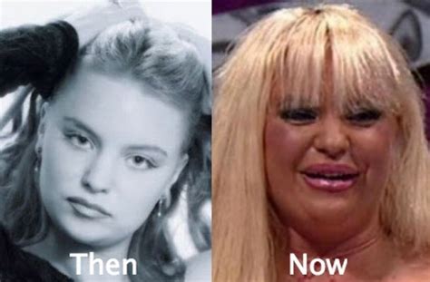 Plastic Surgery Gone Bad 53 Celebrity Plastic Surgery Gone Wrong Before