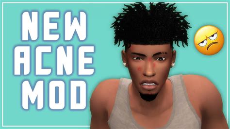 New Acne Mod Review 🤔 The Sims 4 Youtube