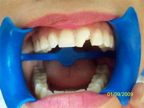 Casos Odontologicos
