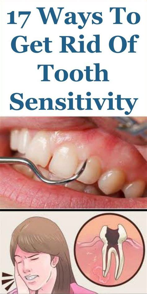 17 ways to get rid of tooth sensitivity fast and naturally tooth sensitivity tooth
