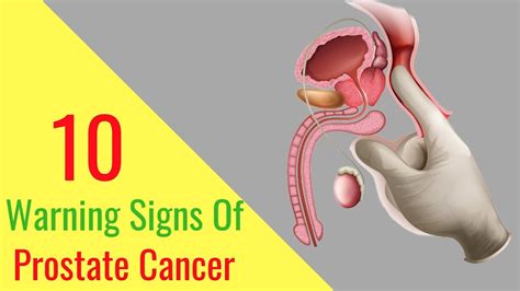 Prostate Cancer Symptoms 10 Warning Signs Of Prostate Cancer You