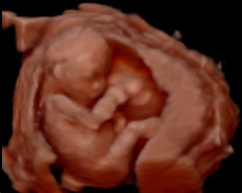 Video Image Gallery Mother Nurture Ultrasound