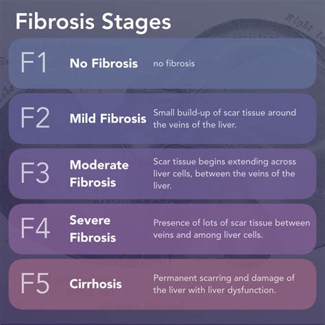 3 Charts What Is Nash Fibrosis A Visual Guide Images