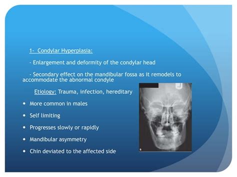 Radiographic Imaging Of Tmj Ppt