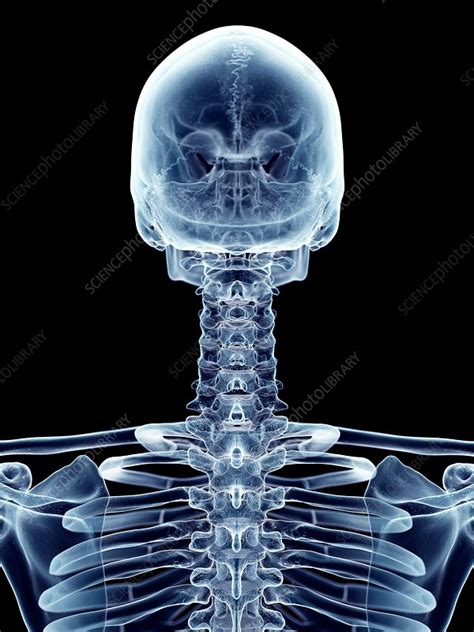 Human Cervical Spine Stock Image F0163253 Science Photo Library