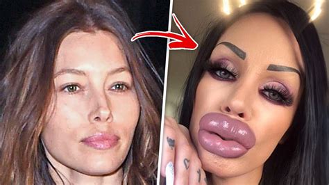 BOTCHED Stars Who Look Unrecognizable After Their Transformation YouTube