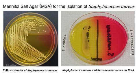 Mannitol Salt Agar For The Isolation Of Staphylococcus Aureus