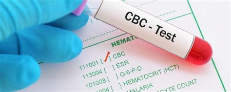 The cbc is often used as a broad screening test to evaluate your general health or to diagnose certain conditions. CBC Test (Complete Blood Count) Purpose,Normal Range & Cost
