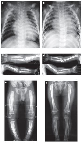 Radiological Features Of The Patient Radiographs Of The Patient