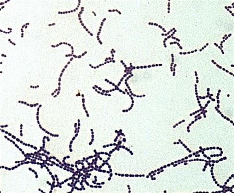 Streptococcus Species Gram Stain Micrograph Era