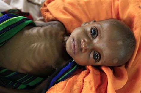 14 Million Somali Children May Face Death From Starvation Unicef