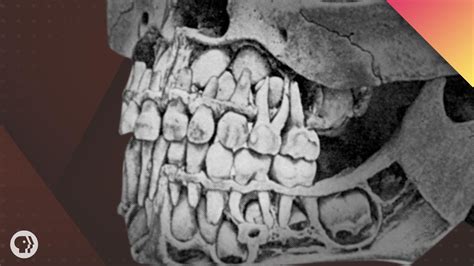 Baby Tooth Teeth Xray Child Jmiller2028