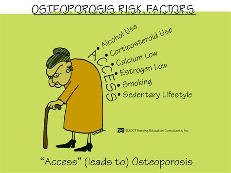 Osteoporosis risk factors #StFrancis | Mother health ...