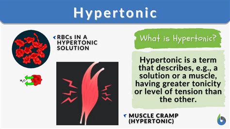 Hypertonic Definition And Examples Biology Online Dictionary