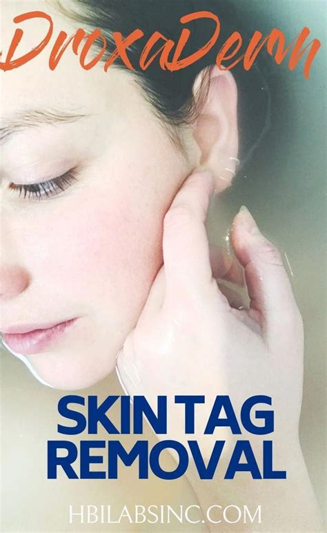 Removing Skin Tags Safely At Home Is Easier Than Ever With Droxaderm The Natural Ingredients