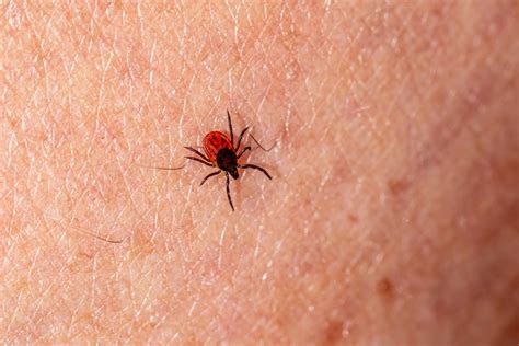 The Process Through Which A Tick Bite Can Lead To The Development Of