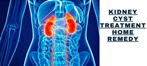 17 Best Kidney Cysts Home Remedies Homenaturalcures