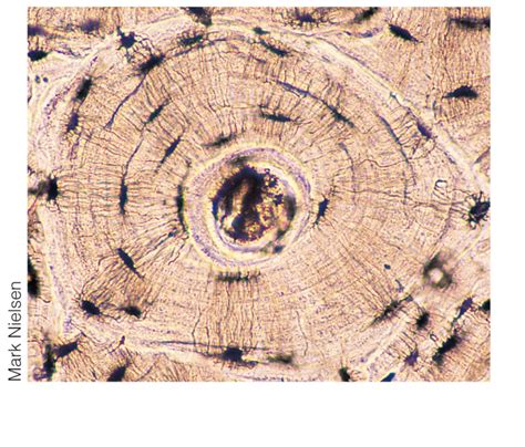 Figure Gross And Microscopic Features Of Compact And Spongy Bone