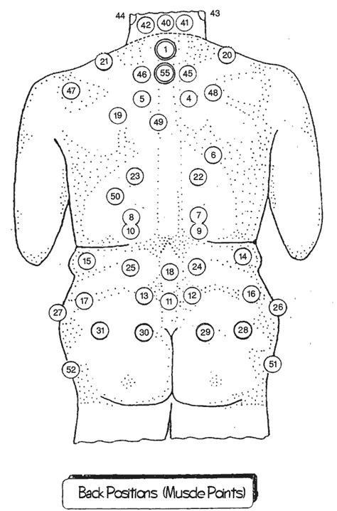 Cupping Therapy Map Of Where To Cup Tcm Traditional Chinese