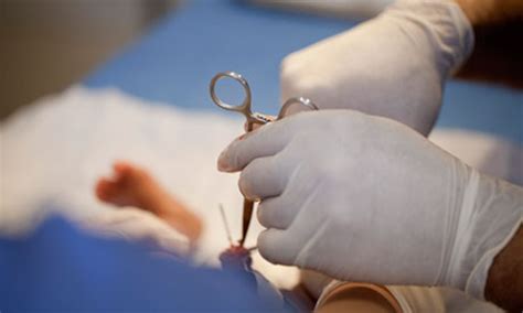Male Circumcision The Unkindest Cut Of All Matt Williams Comment Is Free The Guardian