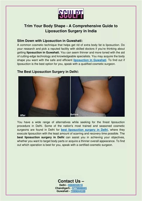 Ppt Trim Your Body Shape A Comprehensive Guide To Liposuction