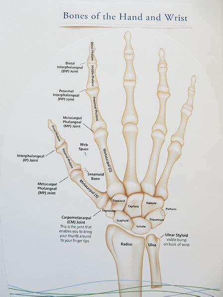 What Is Carpal Tunnel Get The Facts The Carpal Solution