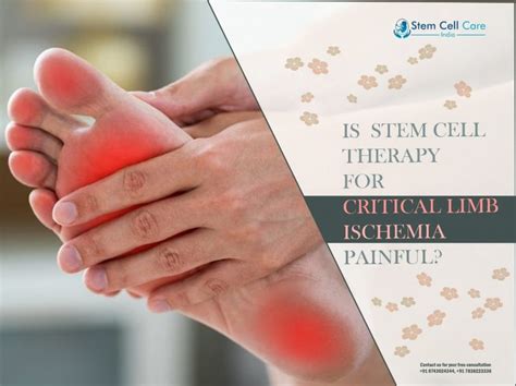 Is Stem Cell Therapy For Critical Limb Ischemia Painful