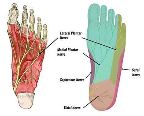 Lateral Plantar Nerve Entrapment Symptoms Causes Treatment