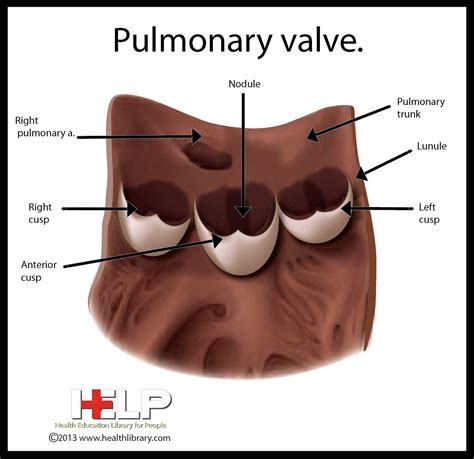 Pulmonary Valve